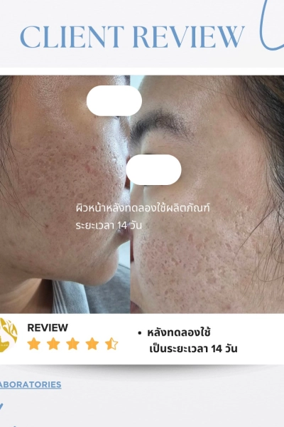 รีวิวจากผู้ใช้จริง ครีม7นางฟ้า และไฮยา